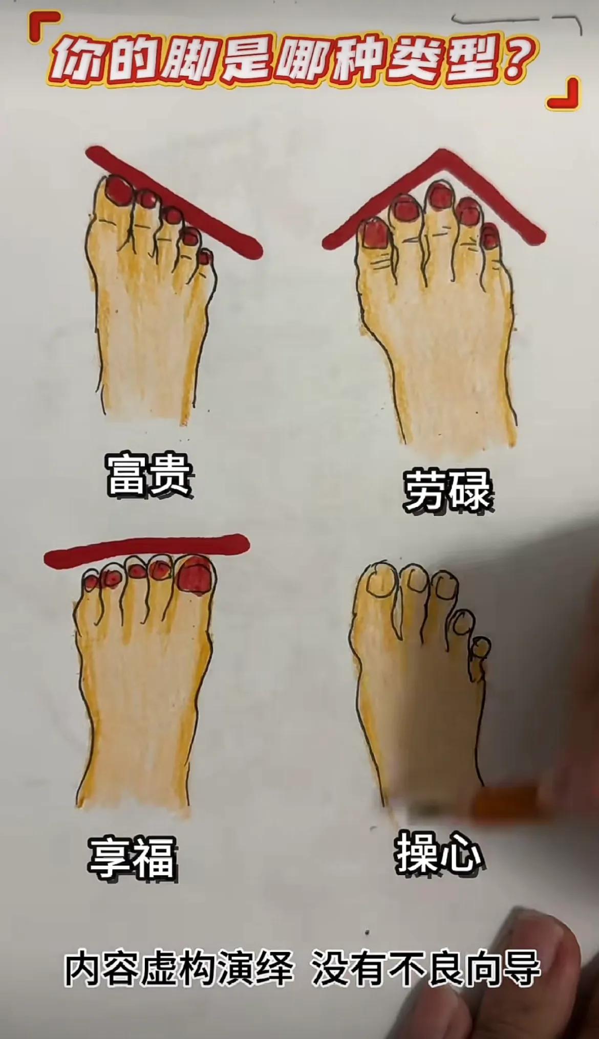 你是哪类型的[憨笑]