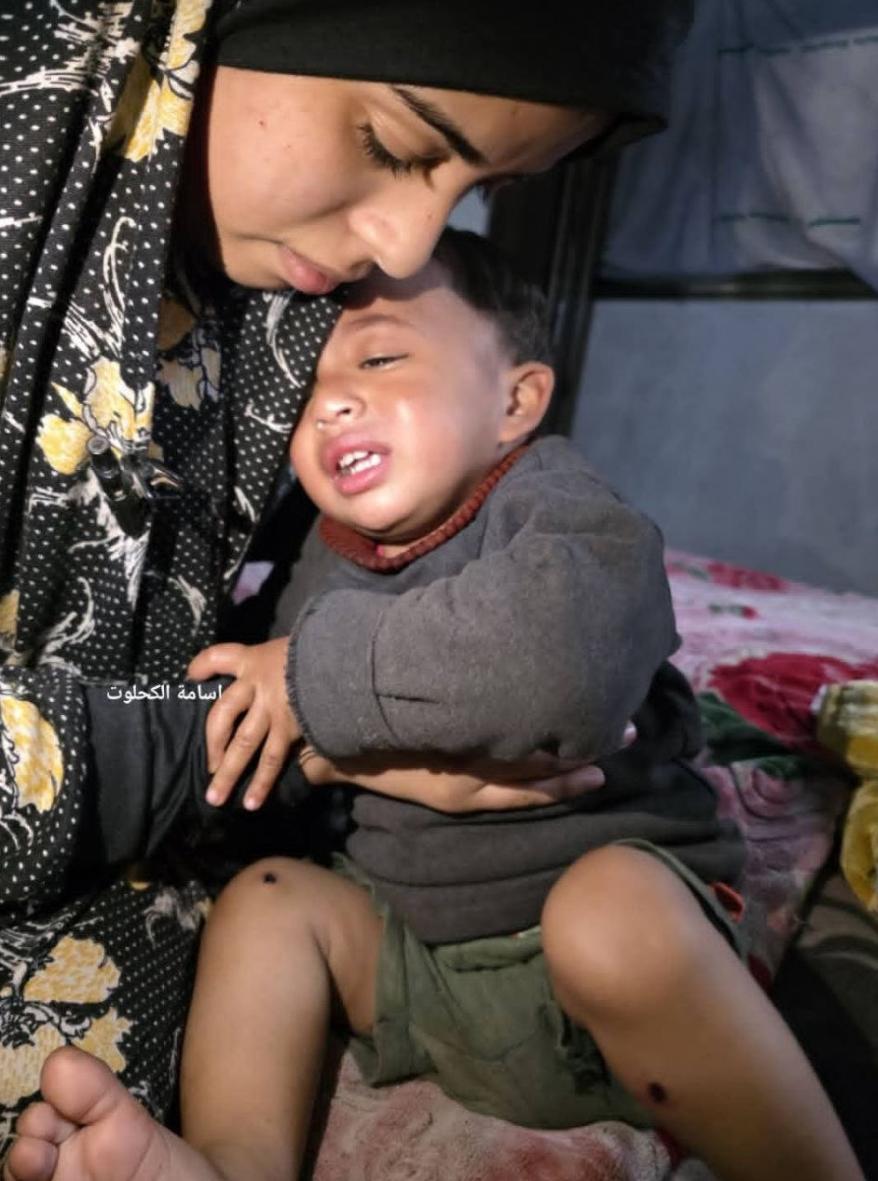 据土耳其国家公共广播公司：以色列士兵在加沙对一名一岁儿童施以酷刑，包括用香烟烫伤