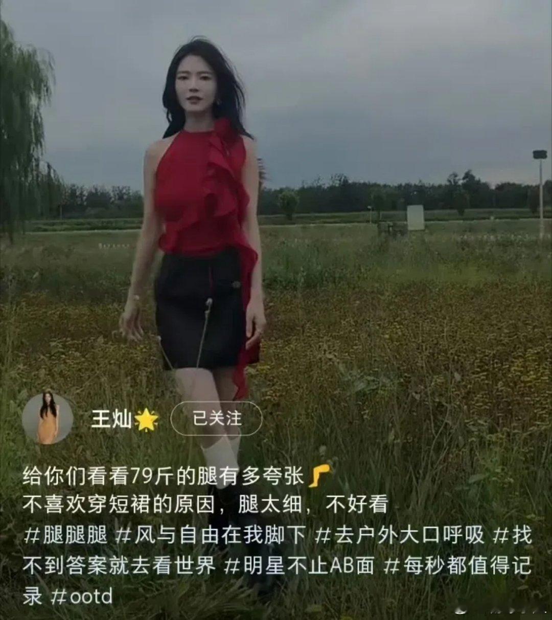 #杜淳妻子王灿患病暴瘦#王灿的腿已经瘦到皮包骨，没有一点肉感和血色[失望][失望