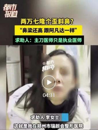 “花2万7做隆鼻，结果鼻子是歪的，模样像阿凡达一样！”近日，郑州市民李女士的医美