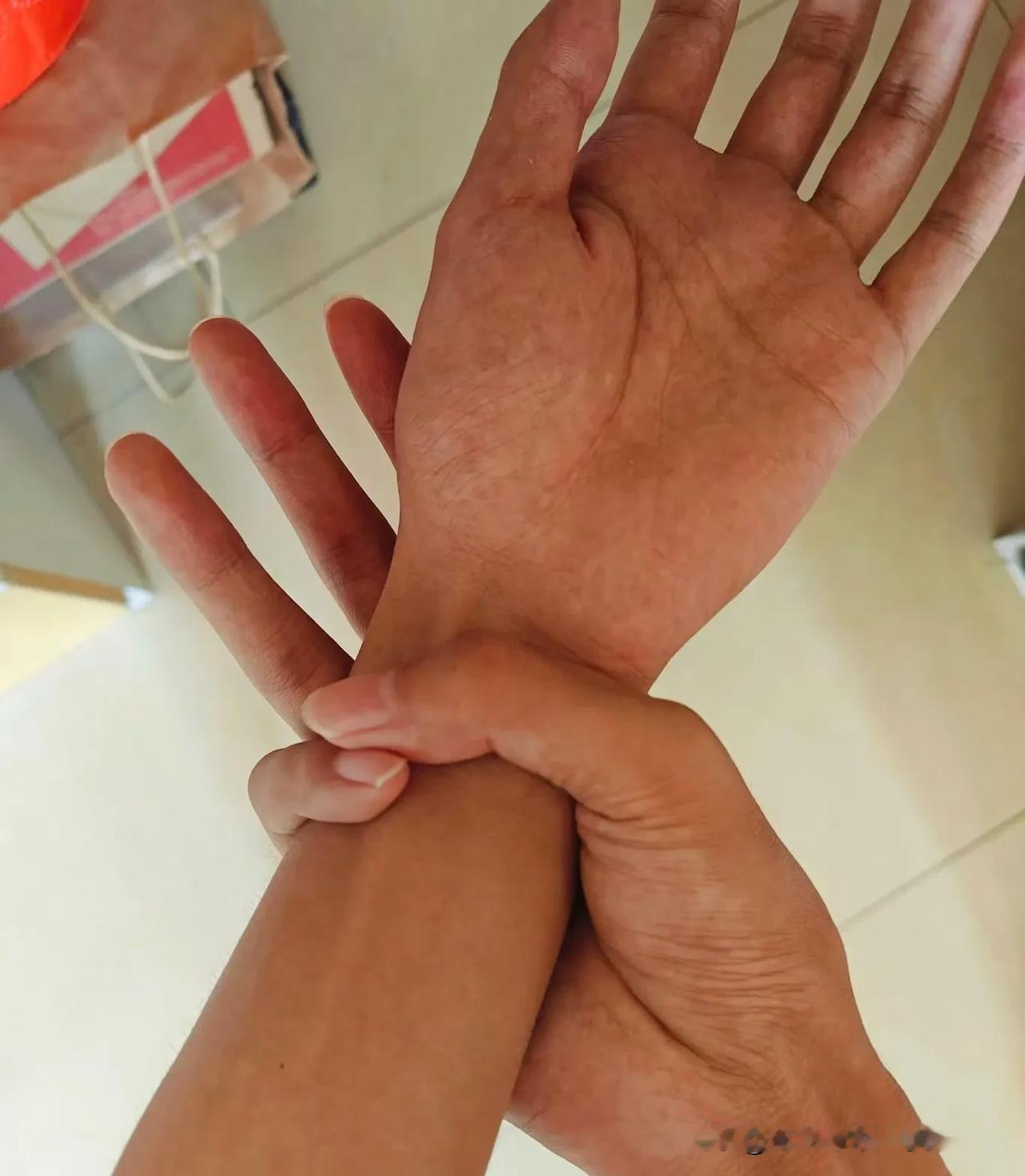 现在的病真的是太稀罕了，长这么大还是第一次听说什么马凡综合症。过年走亲戚见到我二