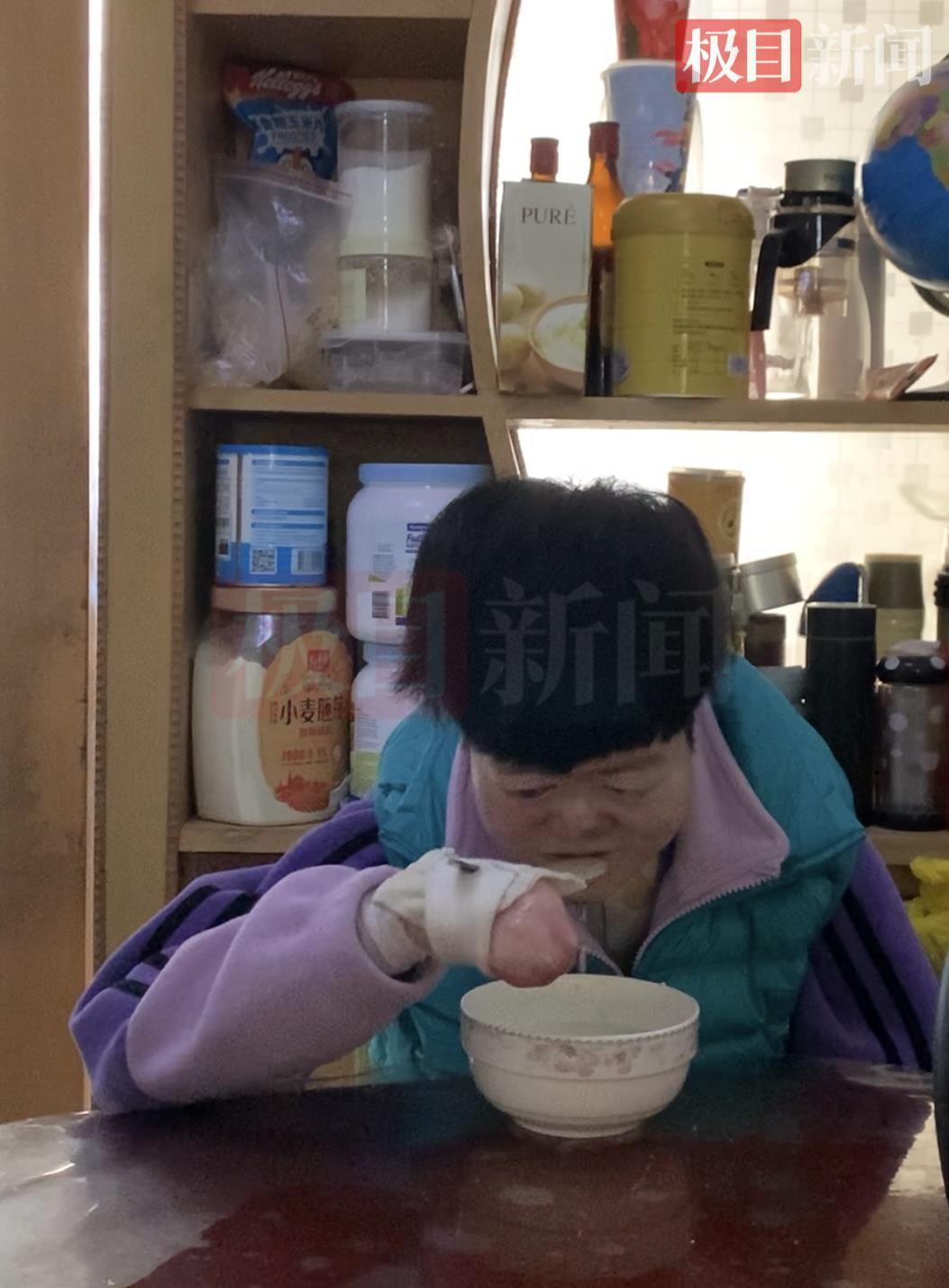 谁能想到，这个皮肤一碰就破的蝴蝶宝贝，出生就被医生判了“生命死刑”，却硬是把2岁