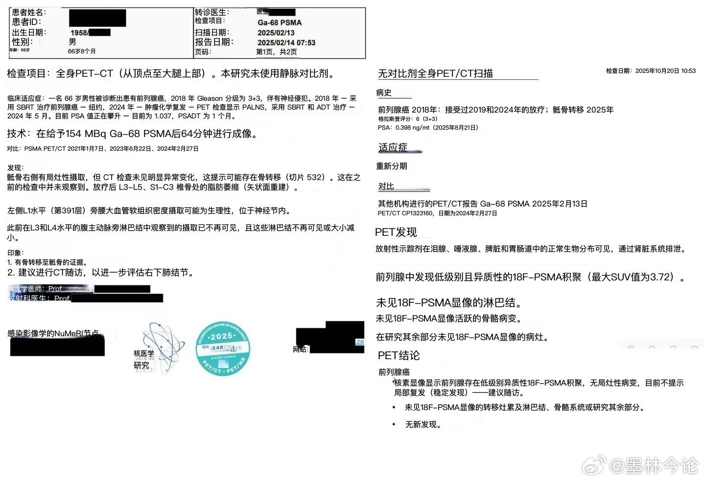 突发新闻：一种可能挽救了斯科特·亚当斯生命的癌症联合疗法，现在又挽救了另一个人的