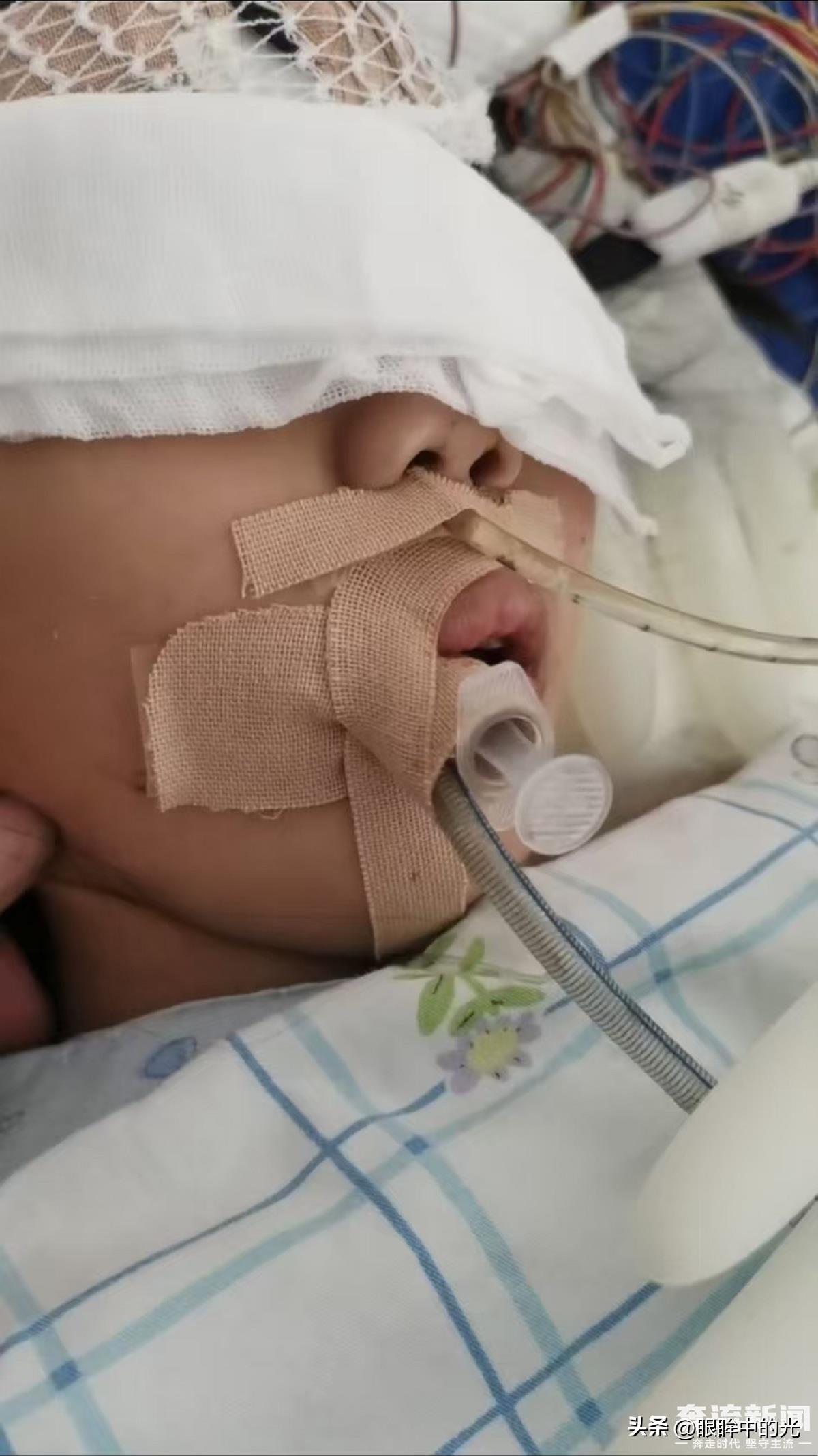 闭环统计系统与线性生命时间

当一台手术被归类为“成功”时，医疗系统记录的是生理