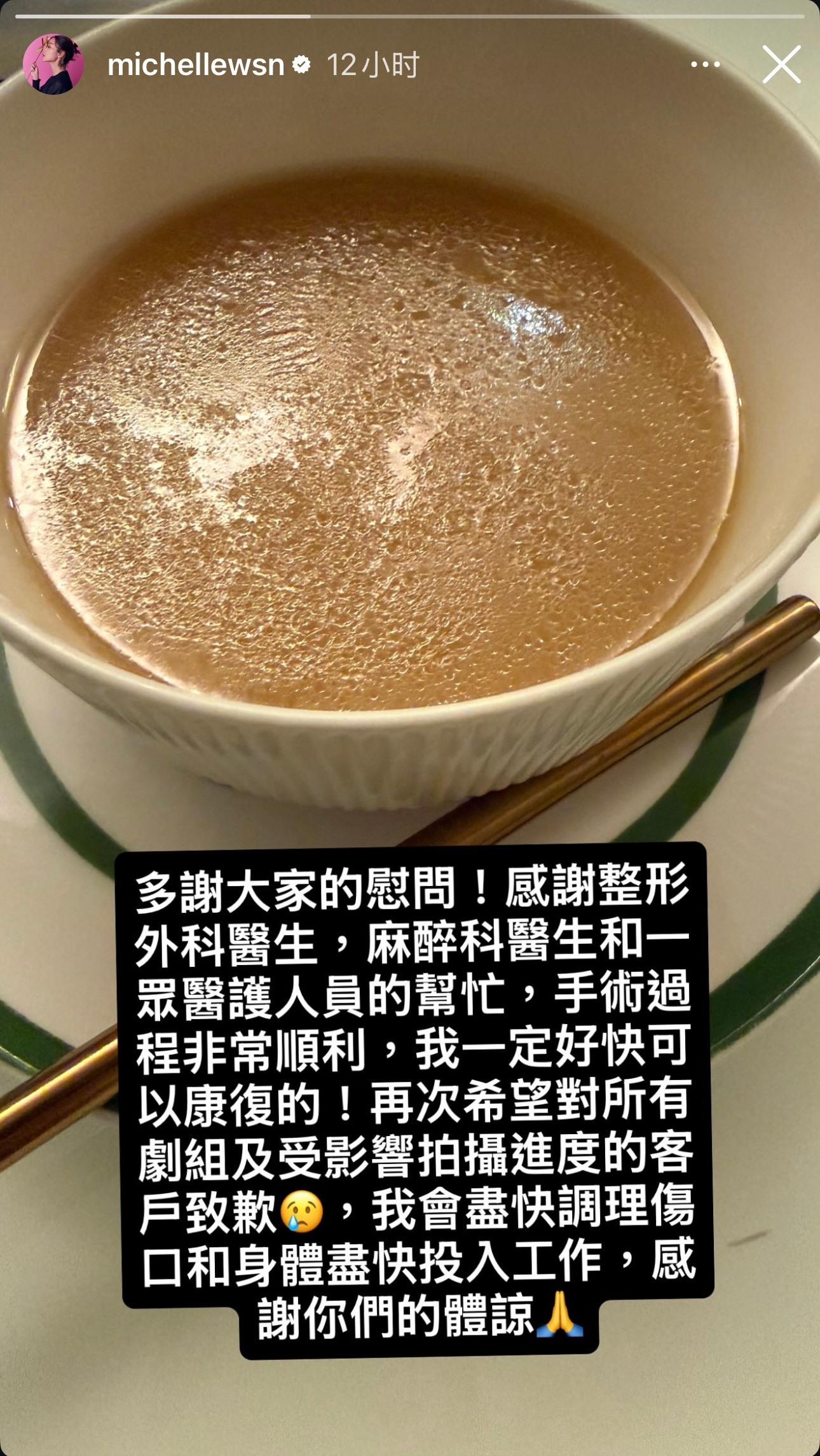 卫诗雅于昨晚拍摄期间发生意外，导致口部及嘴唇受伤，已第一时间送院治理。卫诗雅的丈