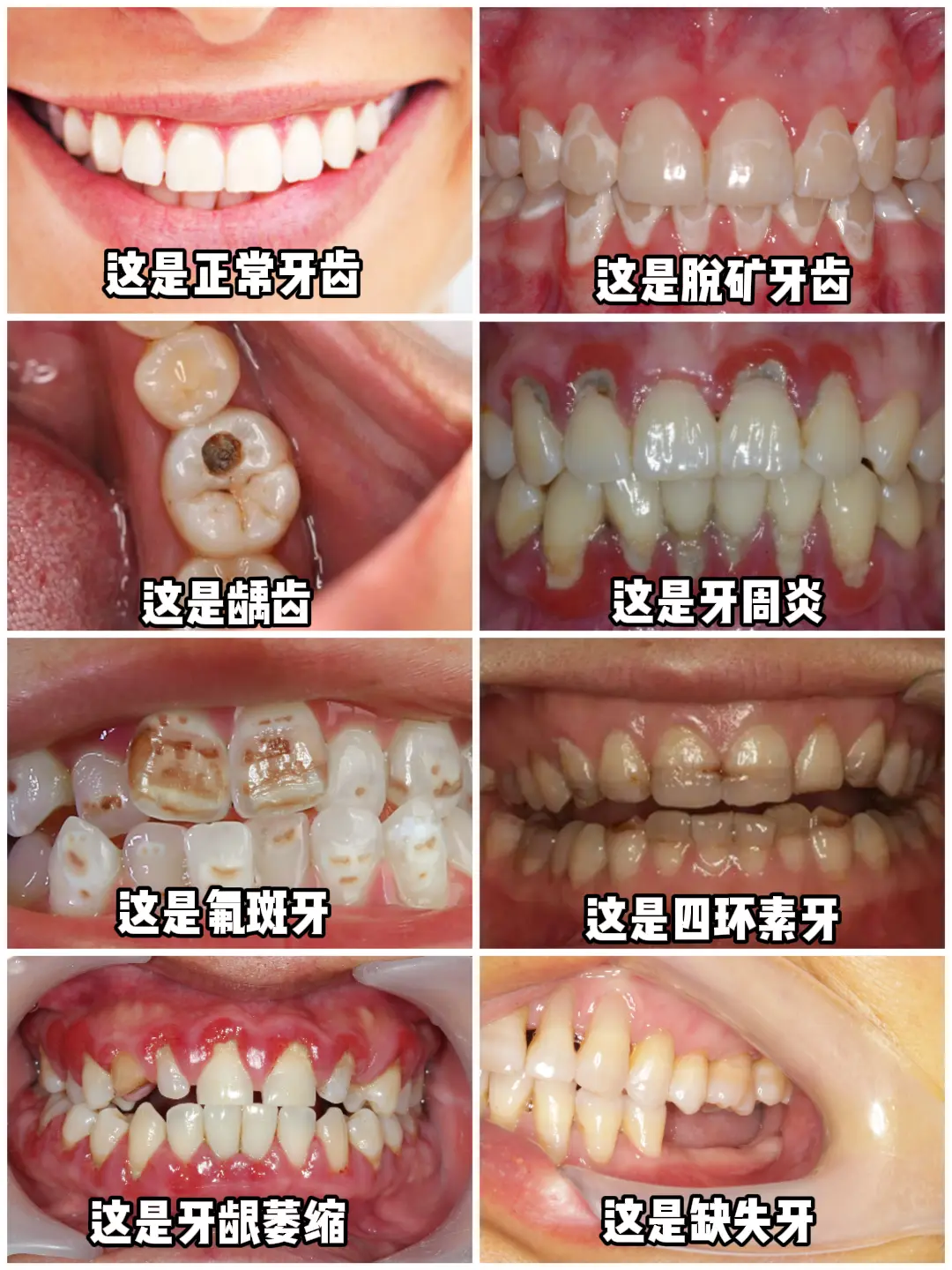 口腔问题大合集~干货！。