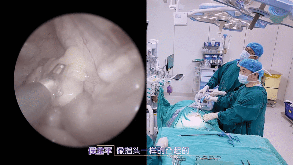 15岁男孩无痛便血十几次失去意识闪闪的儿科医生看完这期《闪闪的儿科医生》务必转发