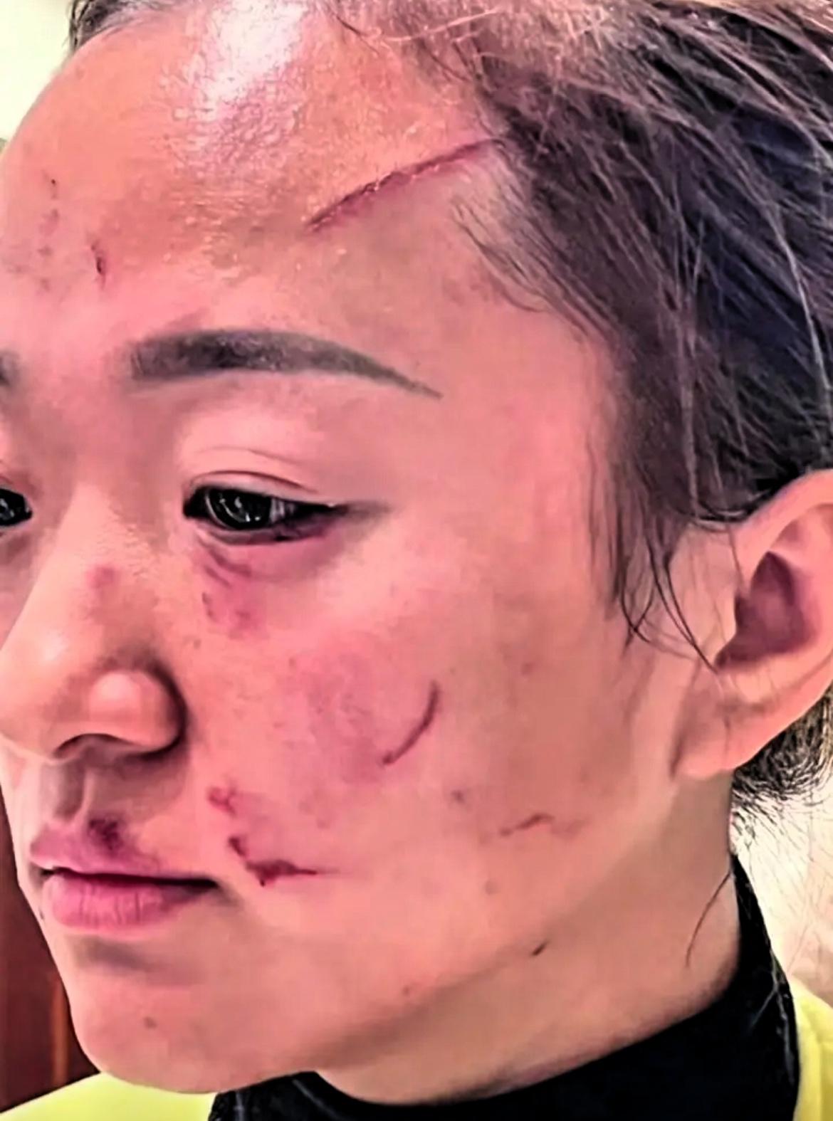 婆婆与媳妇打架后续来了，最终经帽子叔叔调解，婆婆给媳妇5w，以后互不来往。

当