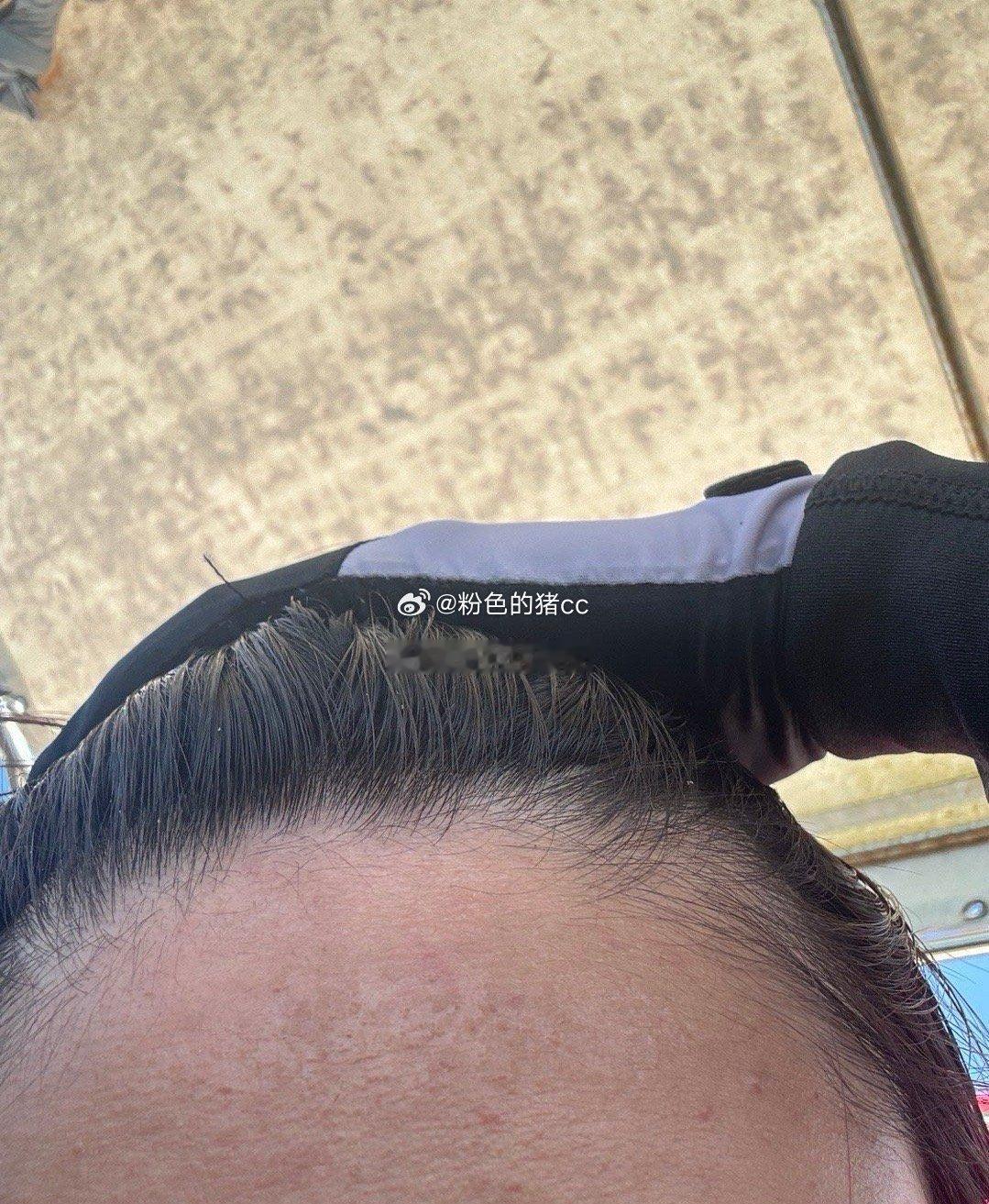 坏消息：晒黑了晒伤了好消息：今天发现自己居然是BTV ​​​