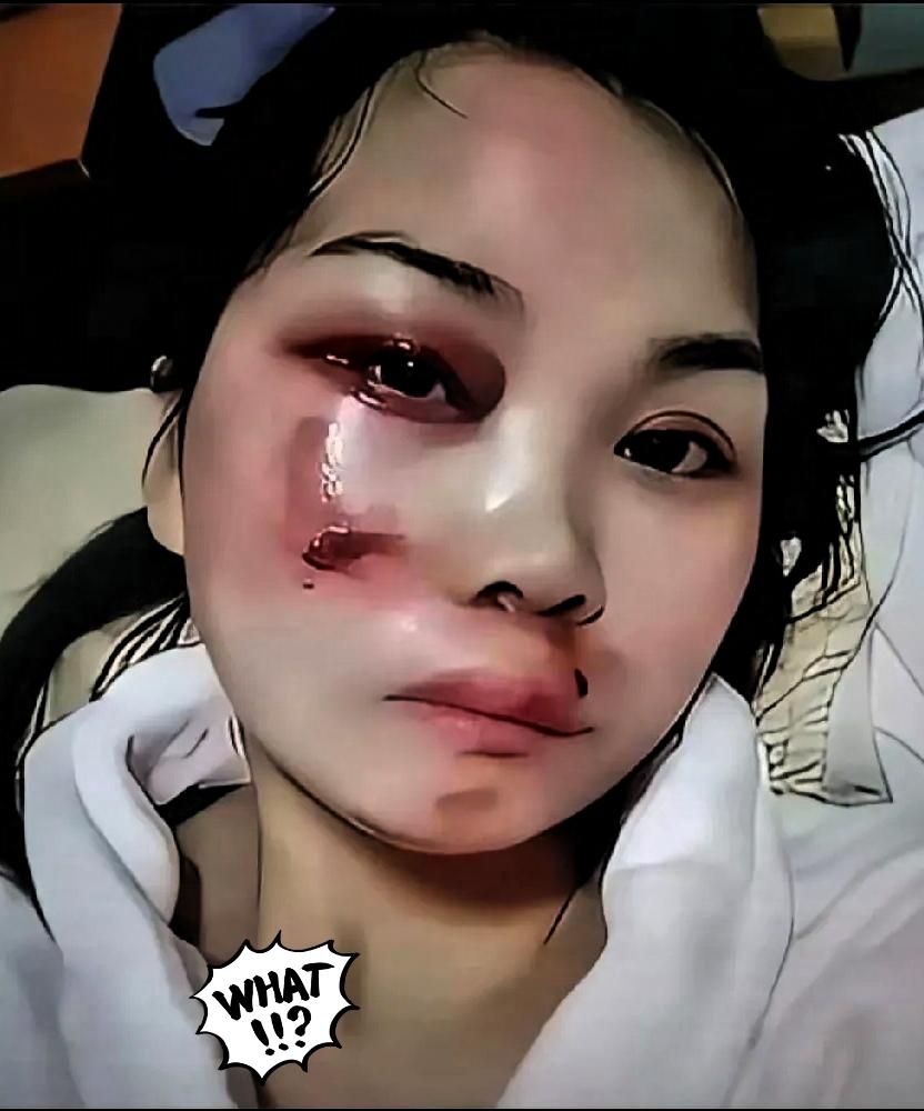 家暴别忍！这次必须刚到底！
 
家暴这事绝不能忍！就说这次事件，女方被男方打断两