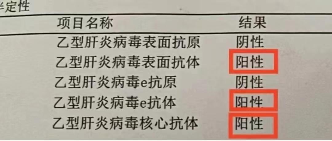 乙肝患者集齐这4种检查结果，不用担心肝硬化了！ 1、乙肝五项第一项表面...