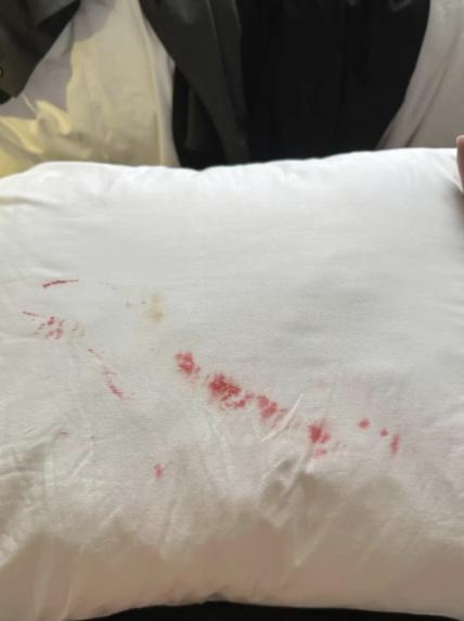 酒店枕套床单多处带血？后续处理更让住客忍无可忍。9 月 2 日报道，江西的罗先生