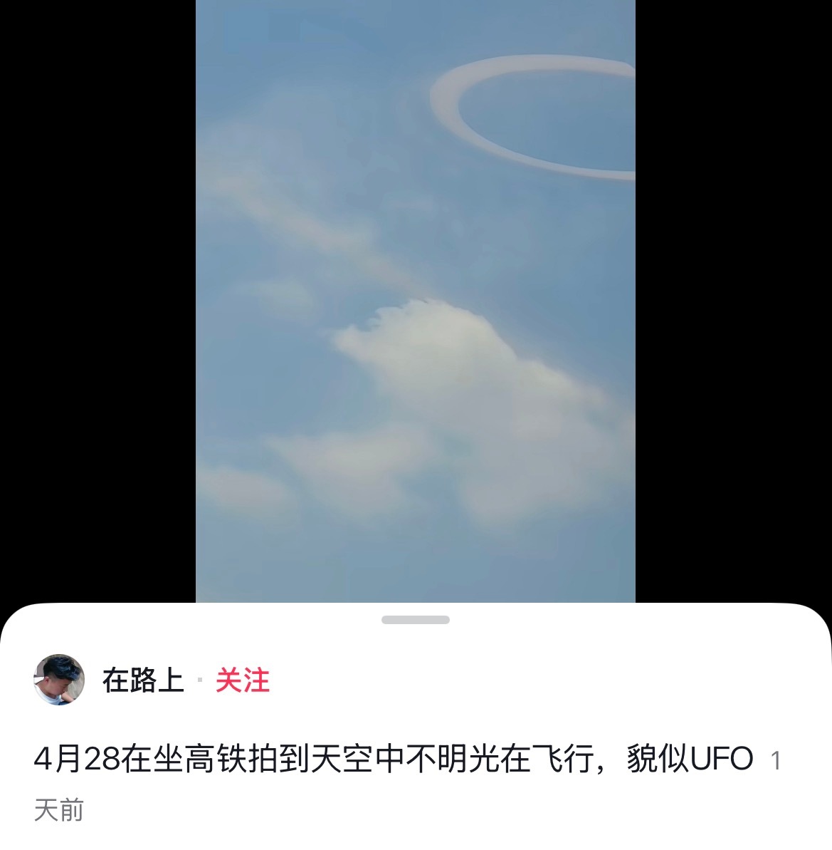 本人视力水平： 