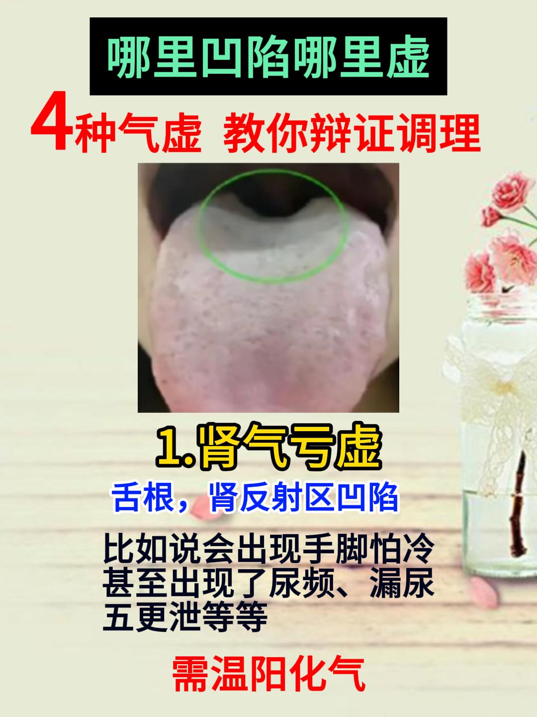 哪里凹陷，哪里虚，4种常见气虚舌象，教你辩证调理[给力][给力][给力]