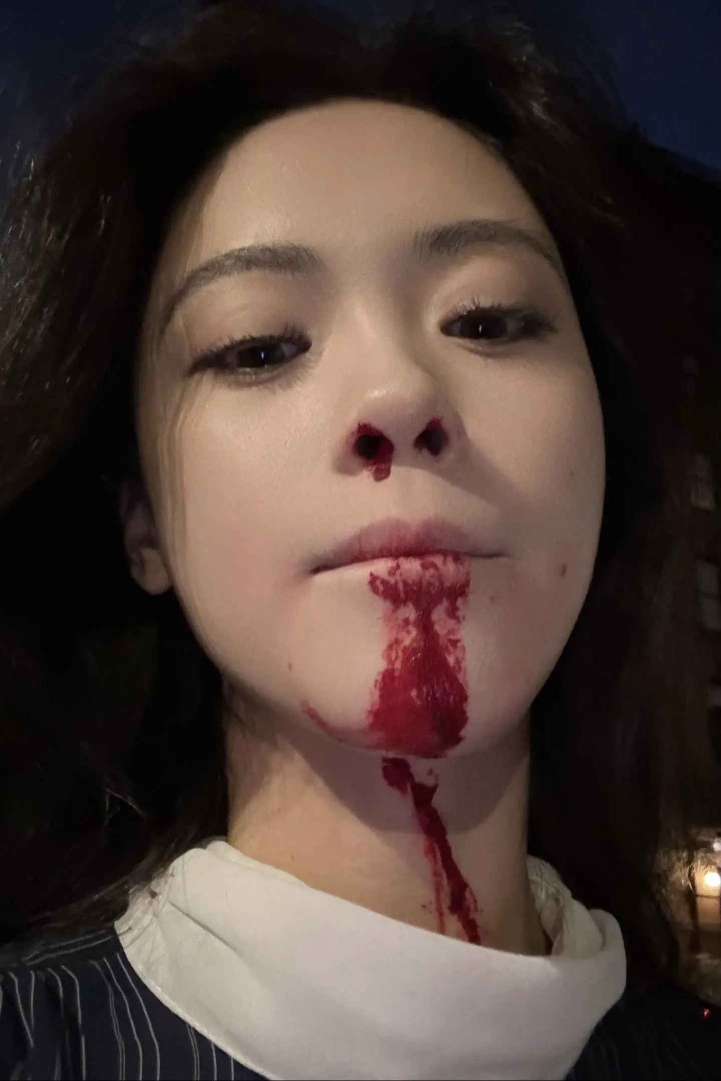被打了