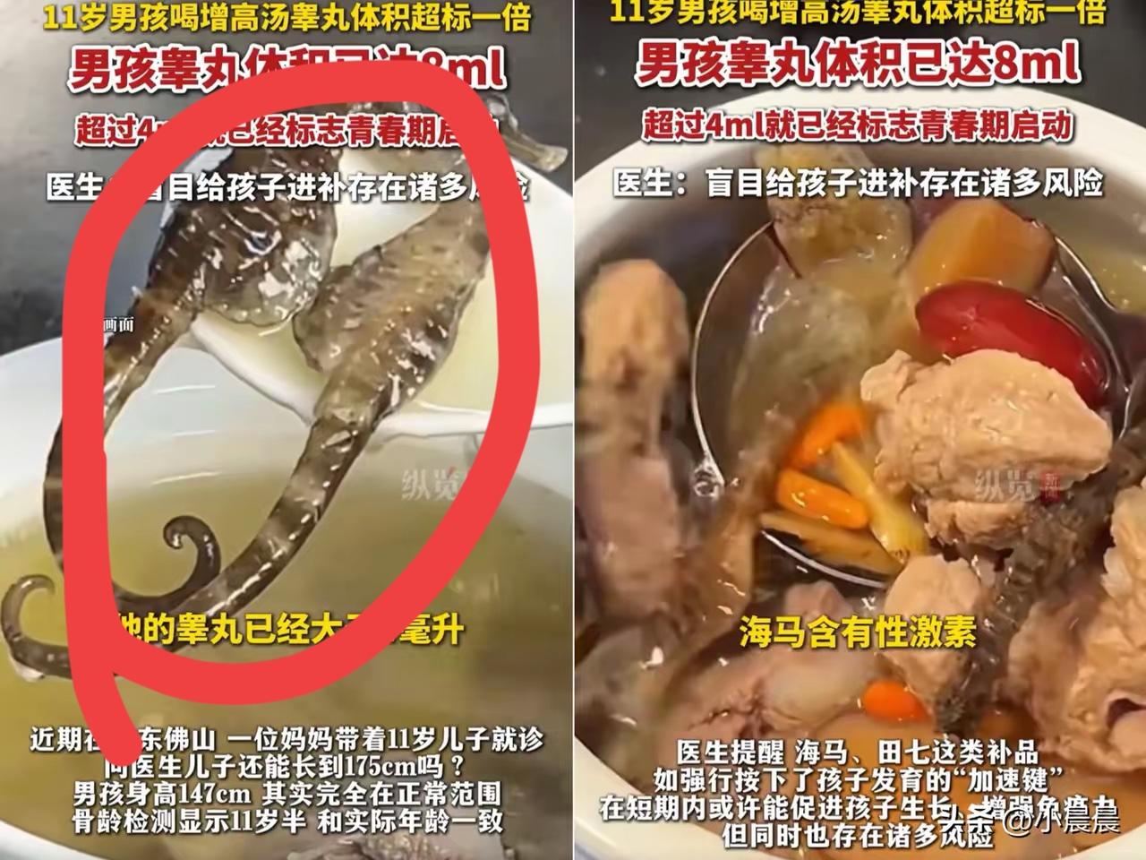 真的要给盲目给孩子“乱补”的家长们敲响警钟！
广东佛山这位妈妈，一心想让11岁儿