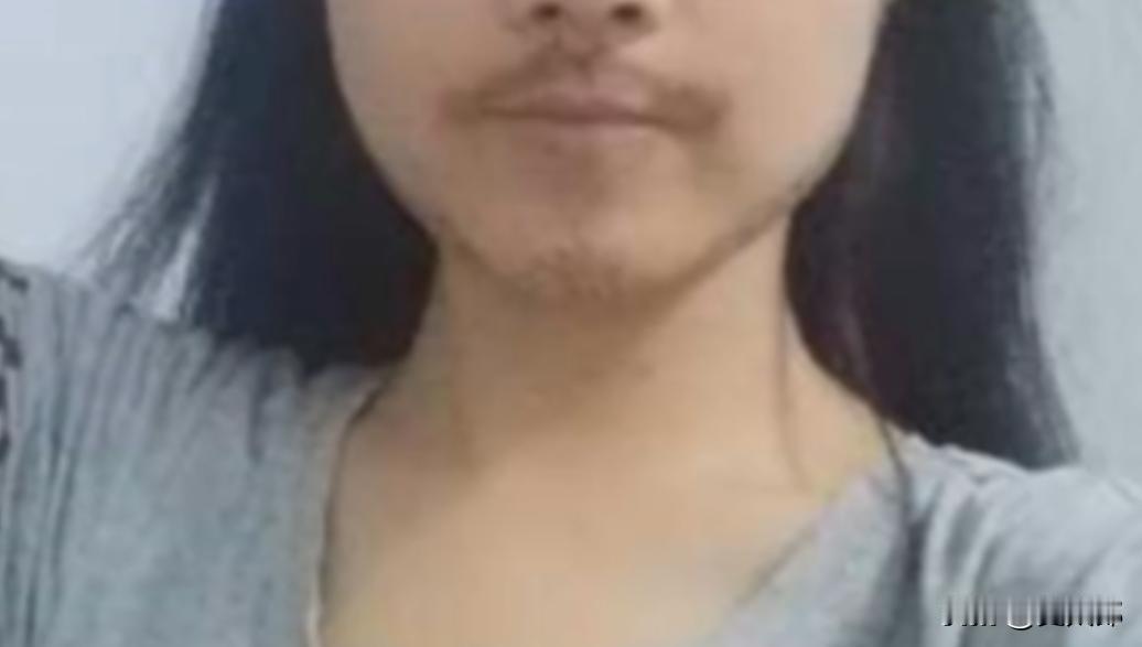 “真是愁坏了”！浙江宁波，一16岁女孩上高中后，月经好几个月不来，脸上痘痘不停长