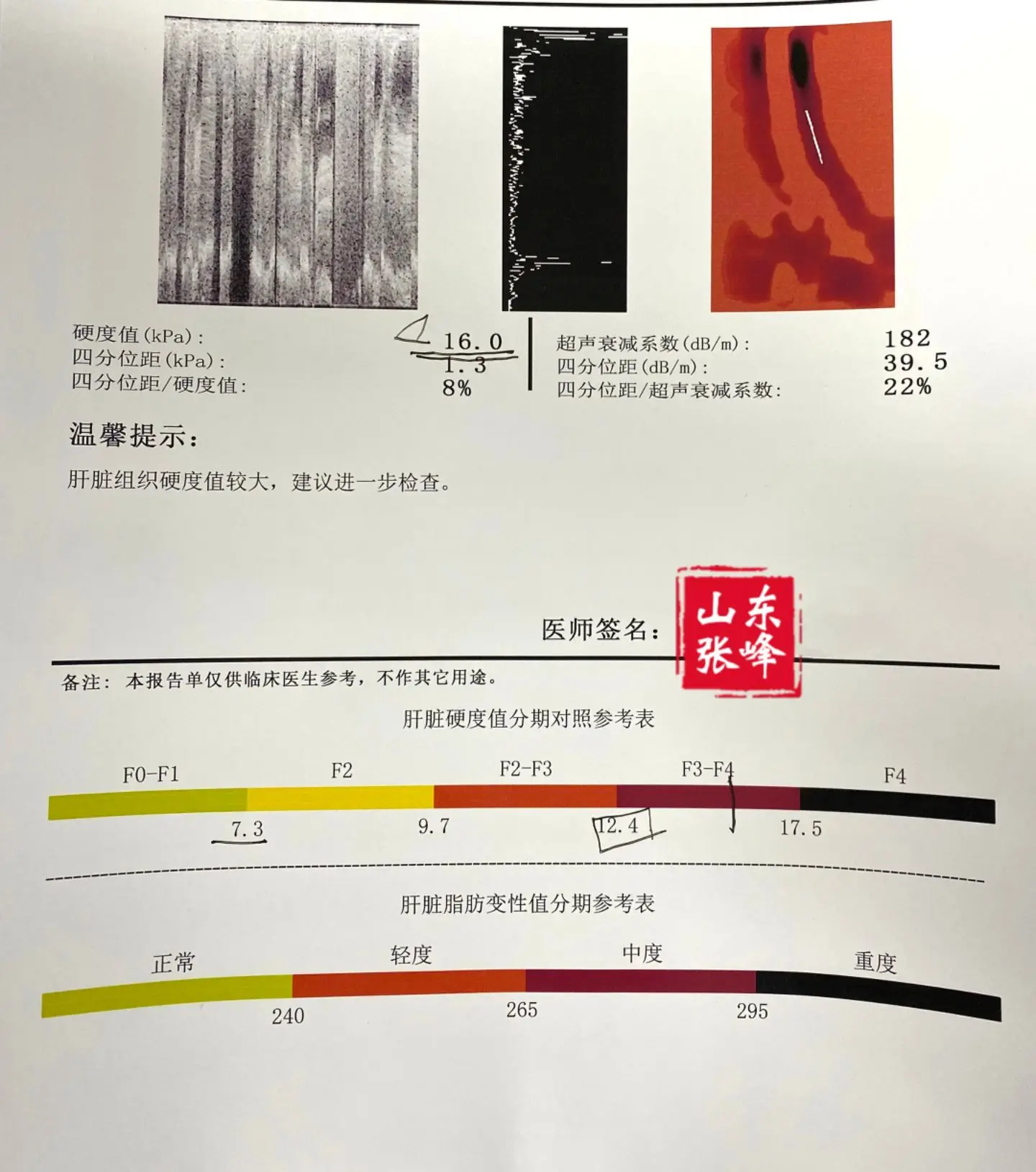 肝硬度值如何看出肝硬化？①如果肝硬度小于7.3，说明肝脏处于健康状态。...