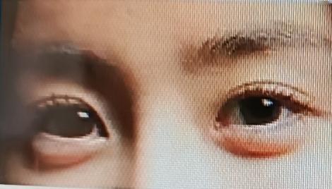 眼睛里遇到状况可太难受了。要是眼睛里有飞虫，千万不能慌。河南省人民医院眼科专家说