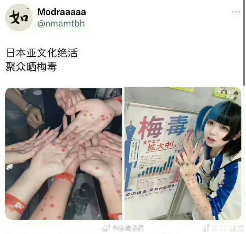 日本流行梅毒妆这帮人神经病吗？真的好恶心，无语了… 广州