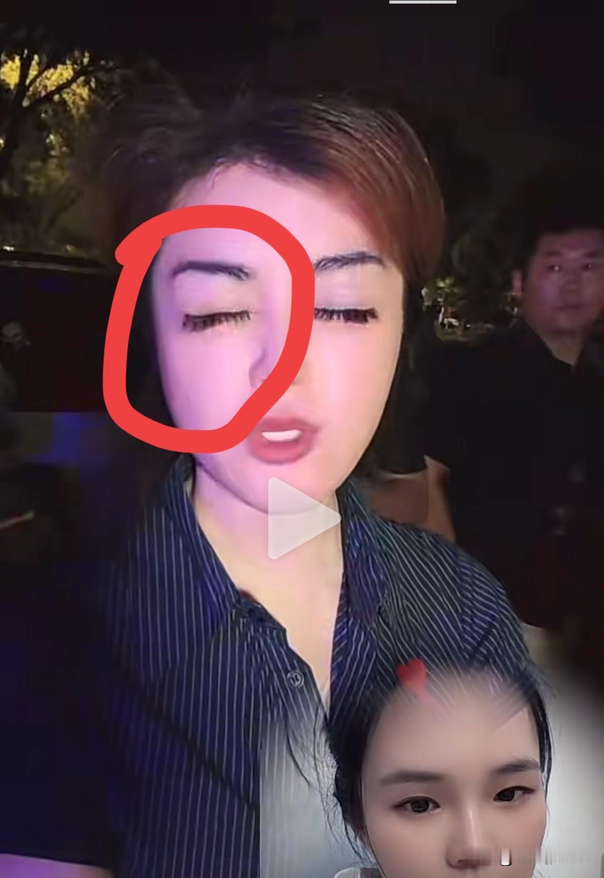 于文红的右侧眼睛闭上之后，睁开时，比左眼睛睁开的慢，左眼睛已经睁开了，右侧眼皮才