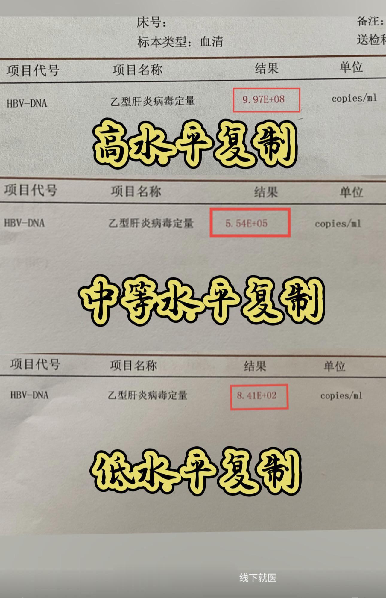 乙肝病毒量降到多少才安全呢？ ①如果病毒量小于10的3次方时，则是低水平复制状态； 
②如果病毒量在10的3次方至5次方之间时，一般考虑中等复制状态； 
③如果病毒量大于10的6次方时，一般考虑为高病毒载量，表示病毒复制很活跃； 
如果你服用抗病毒药物已经超过1年，普通的病毒检测已经检查不到，但是用超高敏检测如果你现在病毒低于20的检测下限，证明你的乙肝病毒已经转阴，算是比较安全的范围，这种情况只需要定期复查就可以。 
健康科普 仅供参考 如有不适 请及时线下就医。