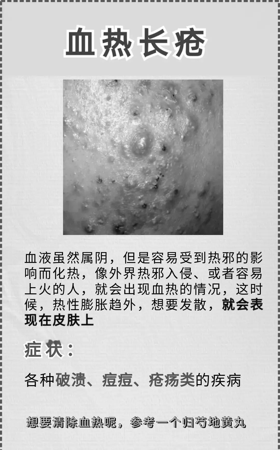 你是否常常感到身体不适，但又不知道具体原因？今天，我们就来一起揭秘身体信号，让你