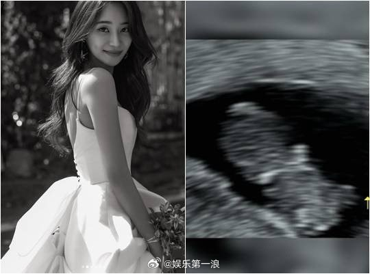 AOA徐酉奈怀孕AOA徐酉奈当妈AOA成员徐酉奈公布怀孕喜讯  4日，酉奈通过个