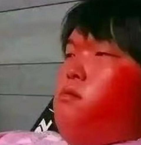 得知Doran要治治自己，要面子的Bin大哥估计如图一了，看看下一场到底谁治治谁