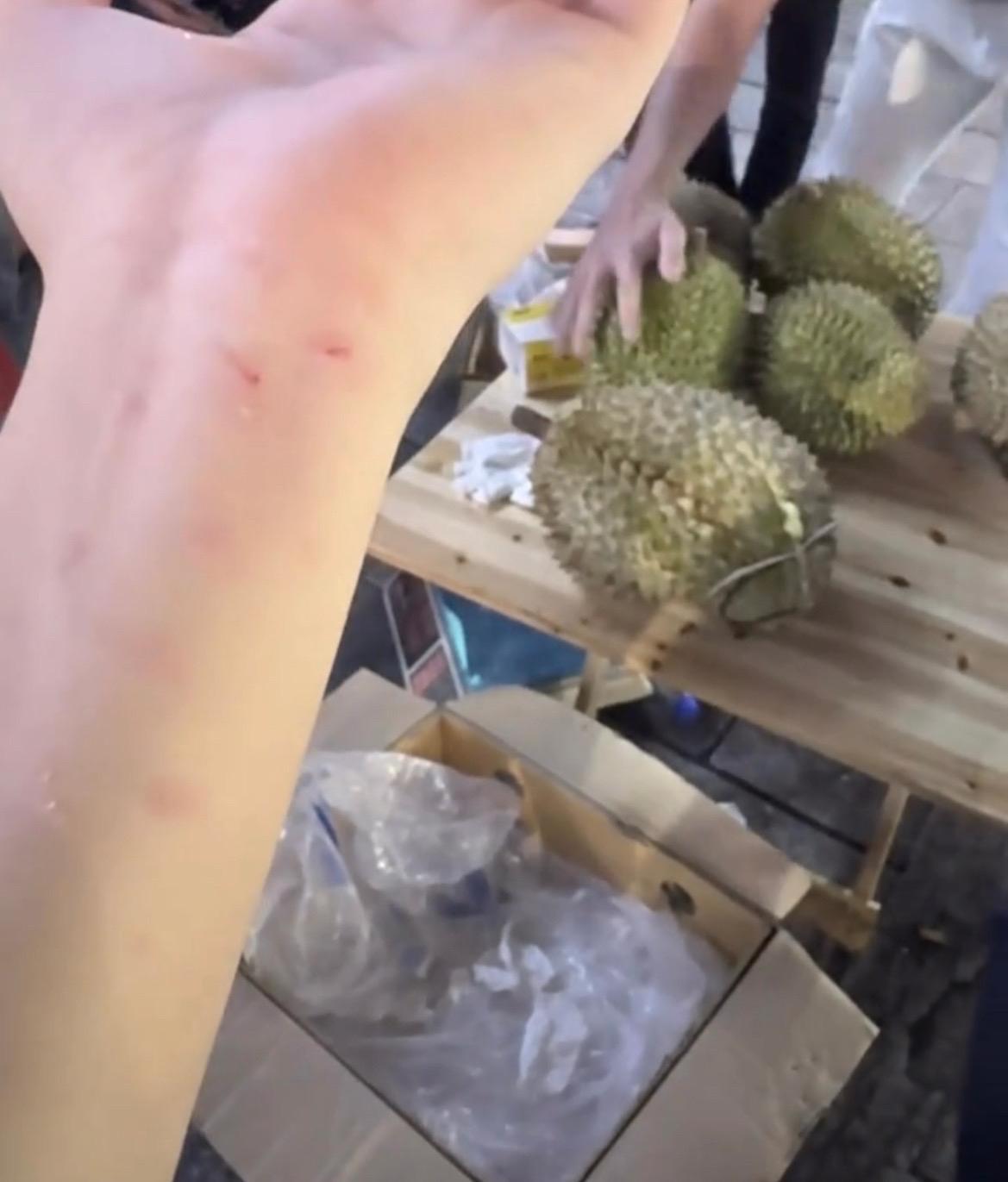 【玉林网友单手提榴莲不小心把手砸到了】

7月2日，网友爆料称：玉林街头的单手提