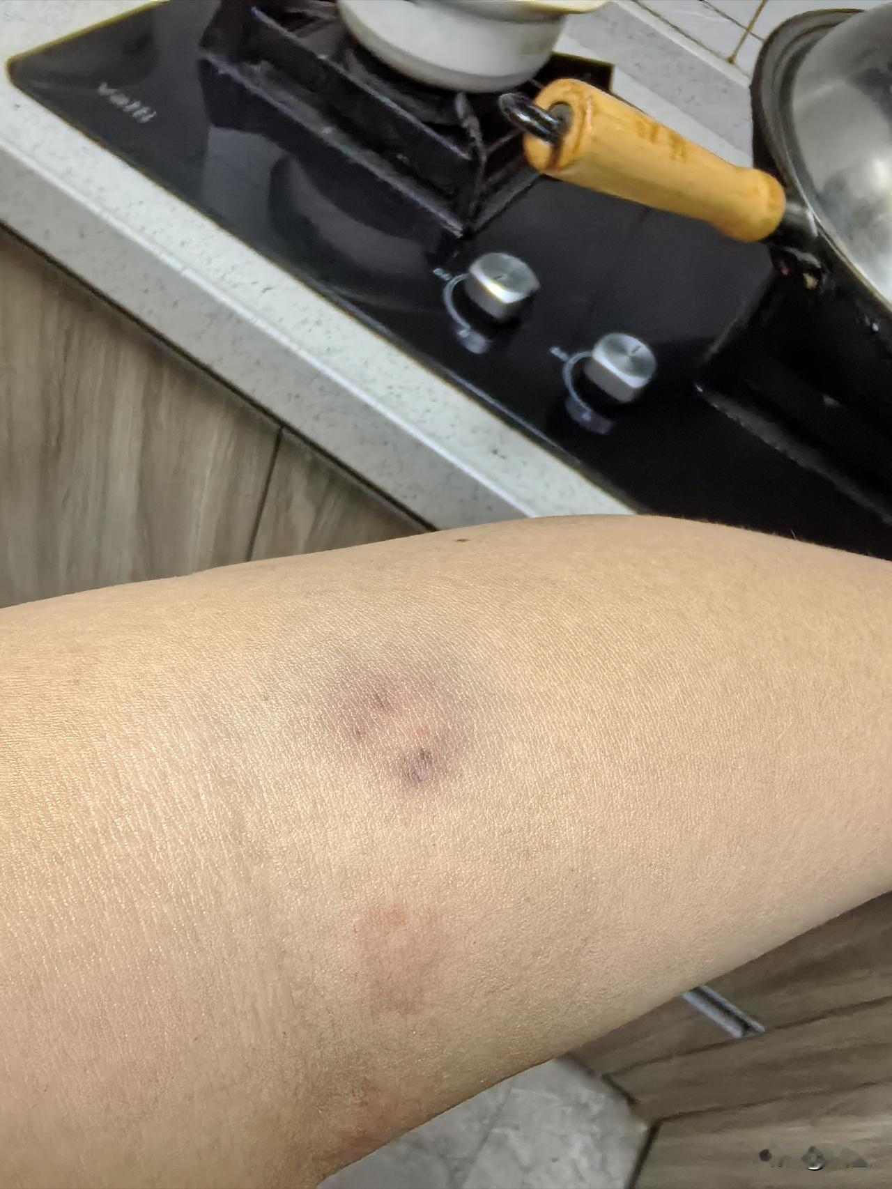 何为生活皆是苦今天单位体检，去抽血遇见同学，给同学的实习生抽的，相当于给她练手，