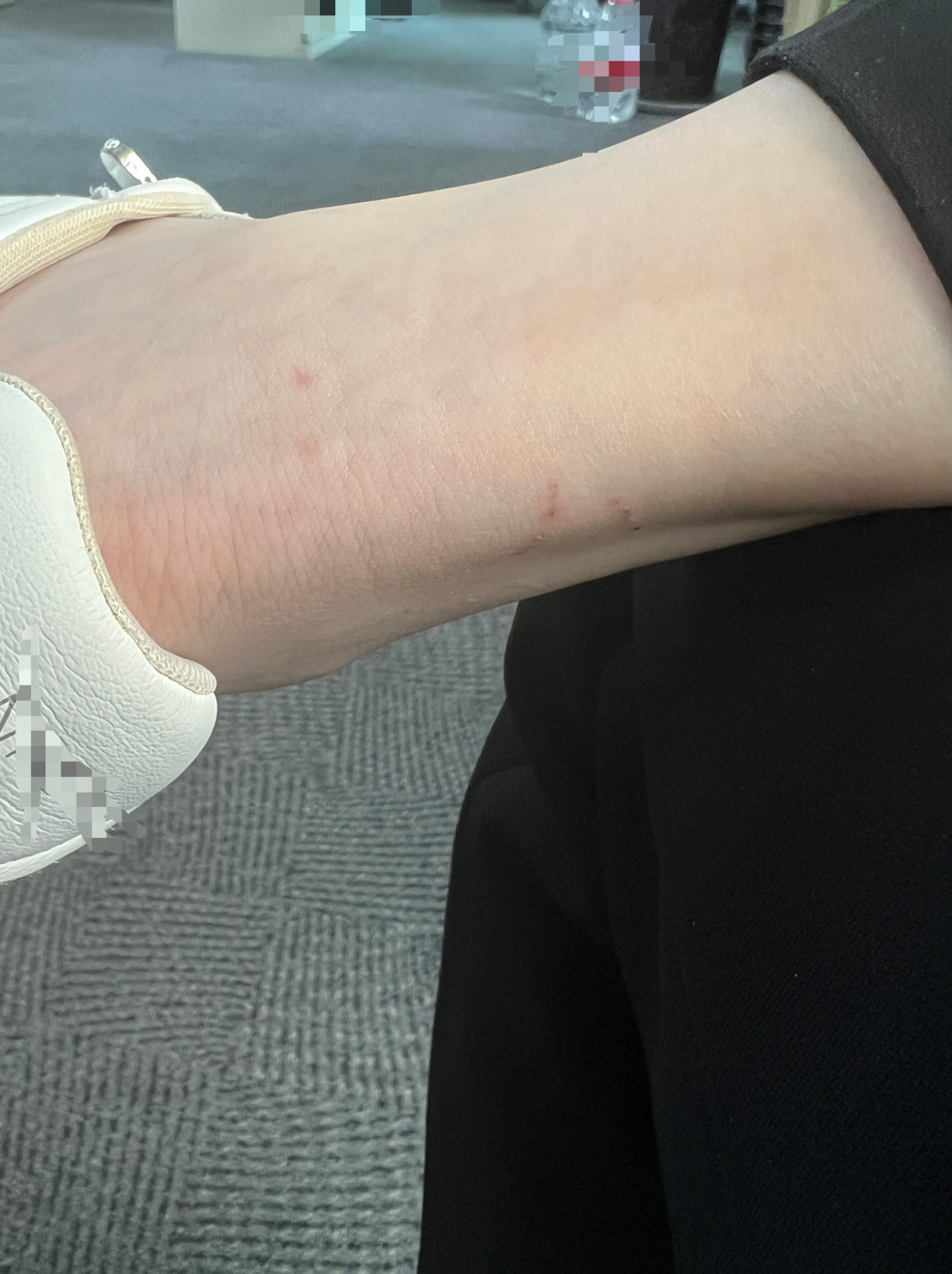 才发现自己的脚脖儿不知道什么时候划破了，都没感觉到疼，这已经快好了才看到！ 