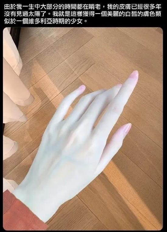 护士最爱的手