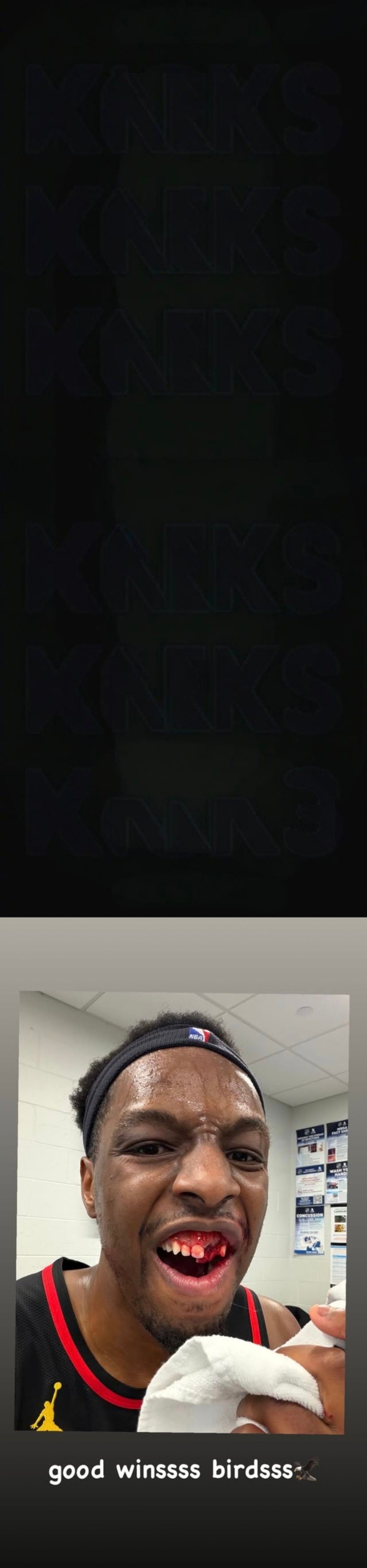 杰伦布朗肘击奥孔古吃恶犯太惨了慎点！奥孔古被布朗肘掉牙齿，赛后晒出牙齿被打掉流血