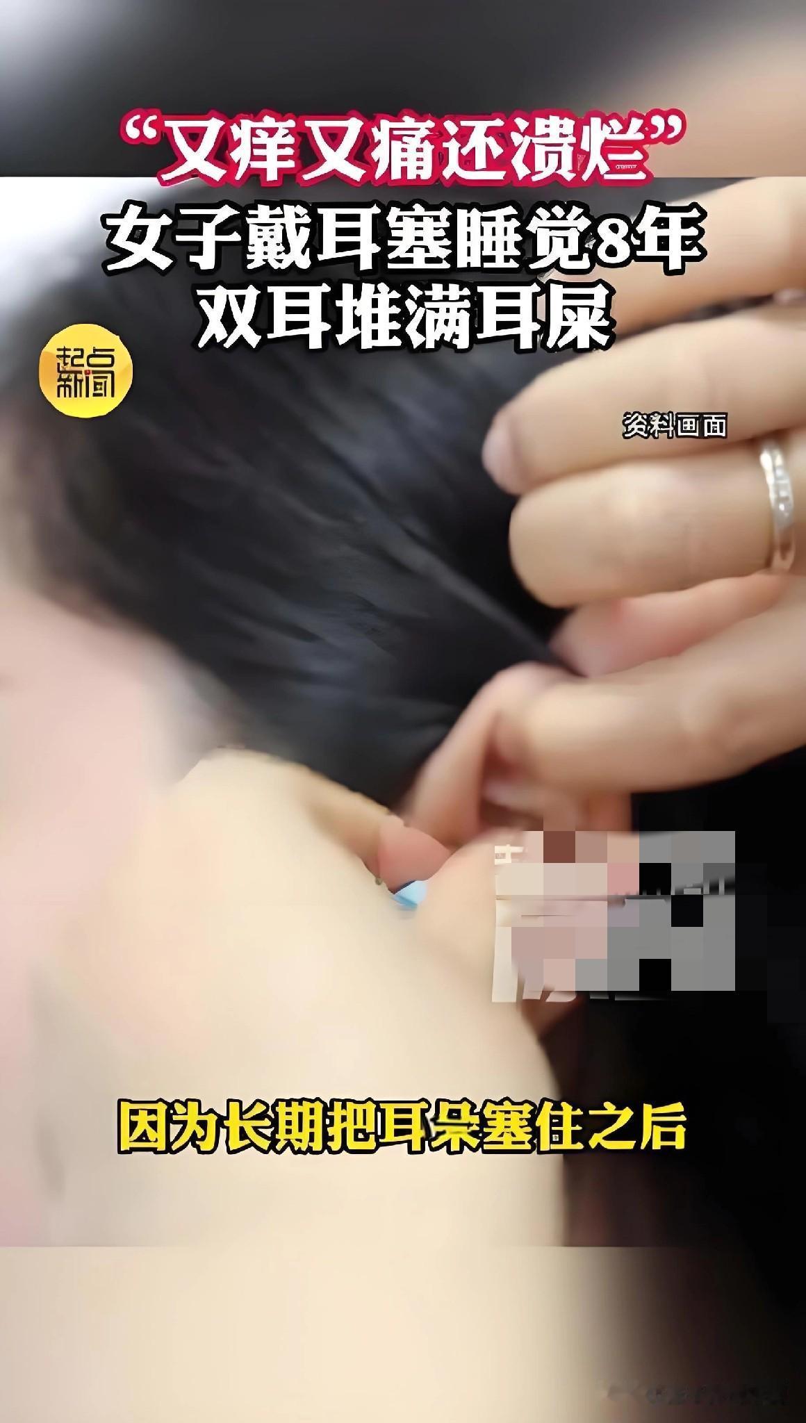 26岁的西安姑娘小杨，8年来每晚都靠耳塞隔绝环境噪音助眠，不戴就根本无法入睡。长