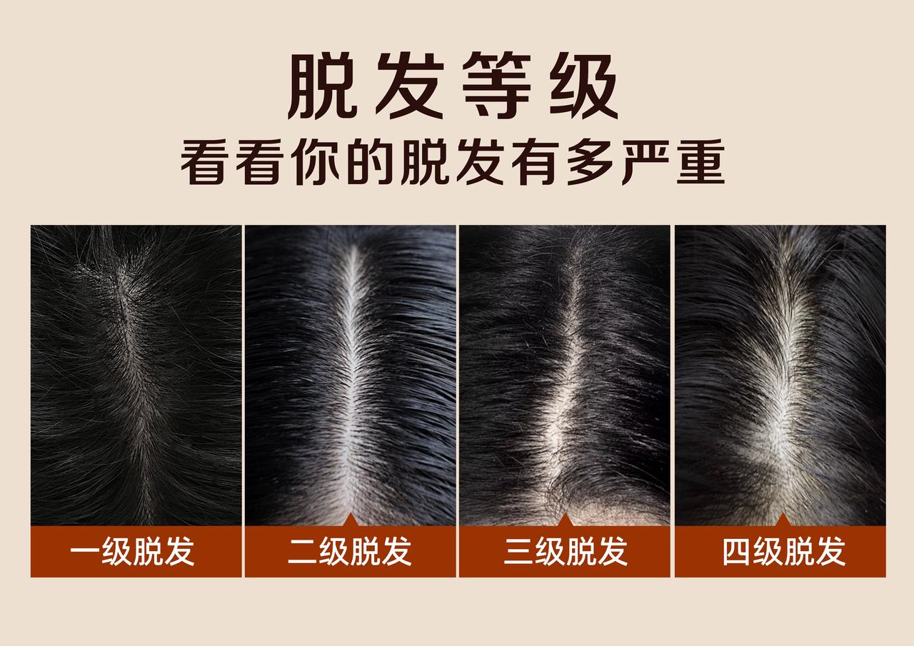 中国脱发人群规模巨大，据行业数据估计超过2.5亿人，随着压力增大、生活习惯变化与