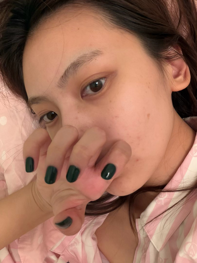 哦哦新美甲 最近一直长痘 好烦！ 