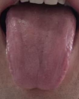 阴虚火旺叠加下焦湿瘀，多种体虚表现该如何调理







近来一位年轻朋友向我