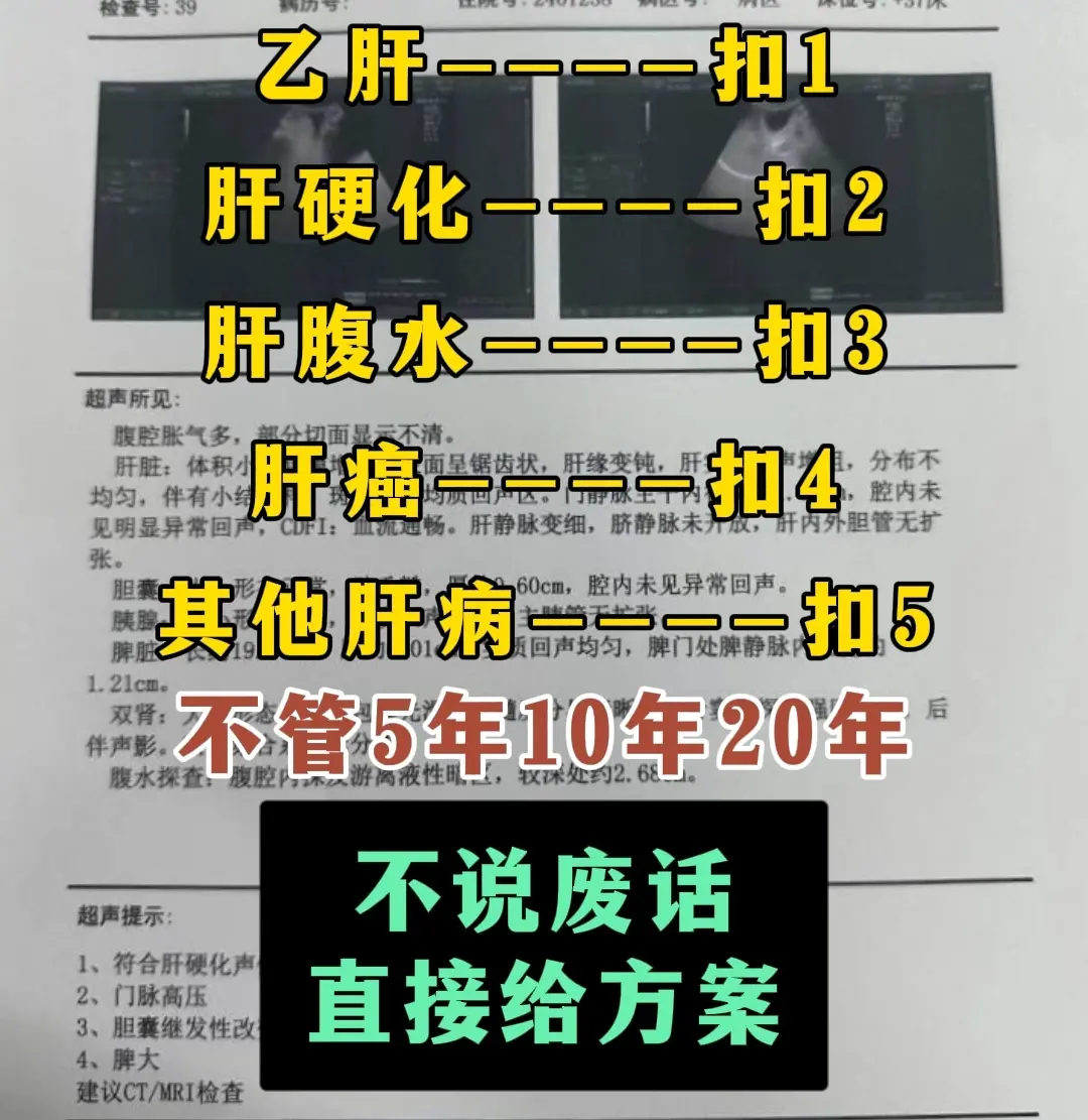 乙肝 肝硬化 山东知道 检查单