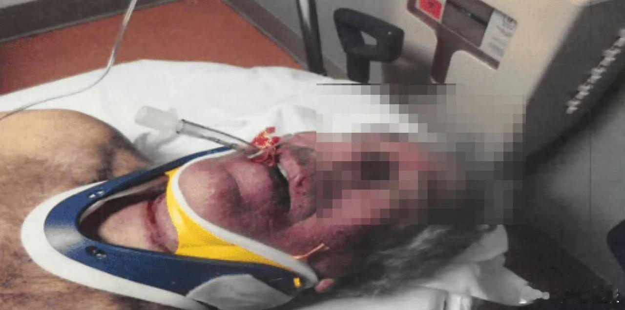 【爱泼斯坦自缢后甲状软骨几乎完全骨折！现场照片首度公开】

美国司法部2月3日公