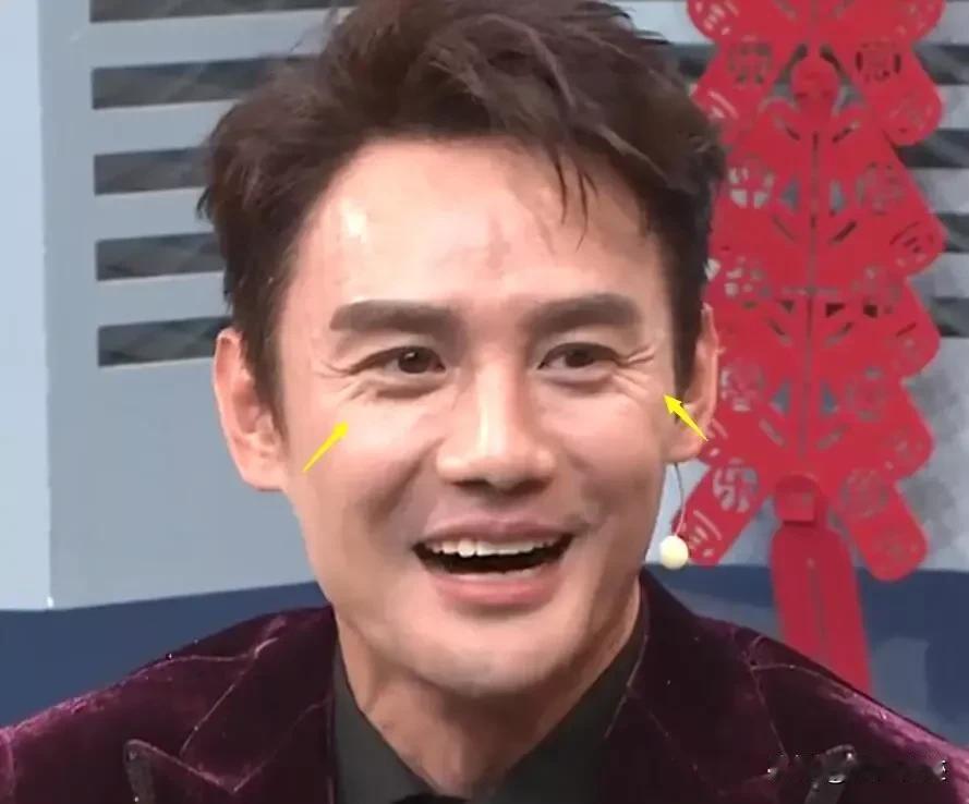 央视的镜头下的王凯……好真实啊，皮肤油，眼角的皱纹能夹死苍蝇，妥妥的中年大叔形象