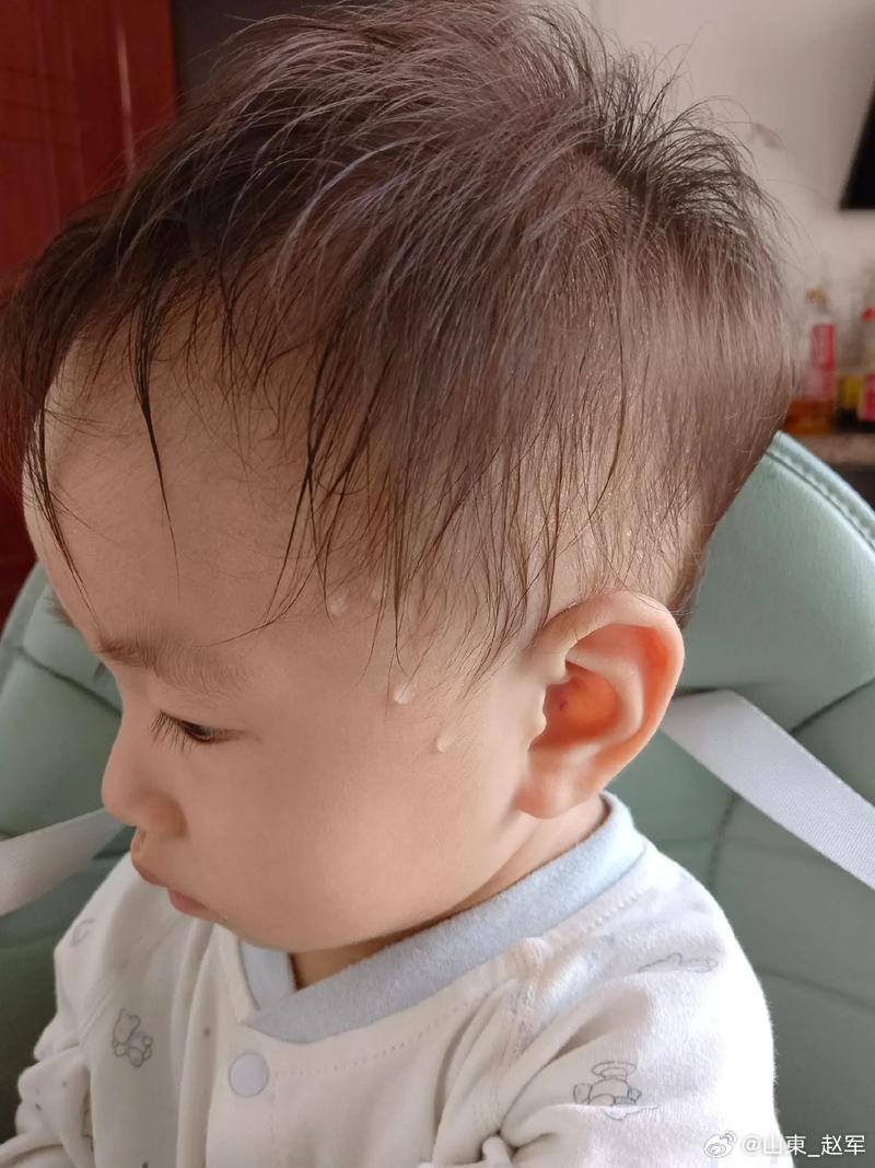 《育婴家秘·诸汗》全文梳理、核心医理与儿科实操总结一、总纲核心病机（小儿出汗根源