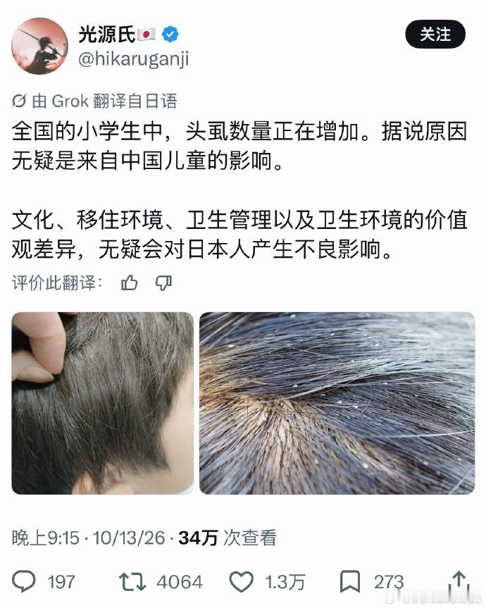 🔻这也能怪中国？是不是有病？🔻感谢热心网友jo分享？热点聚焦海外新鲜事 ​​