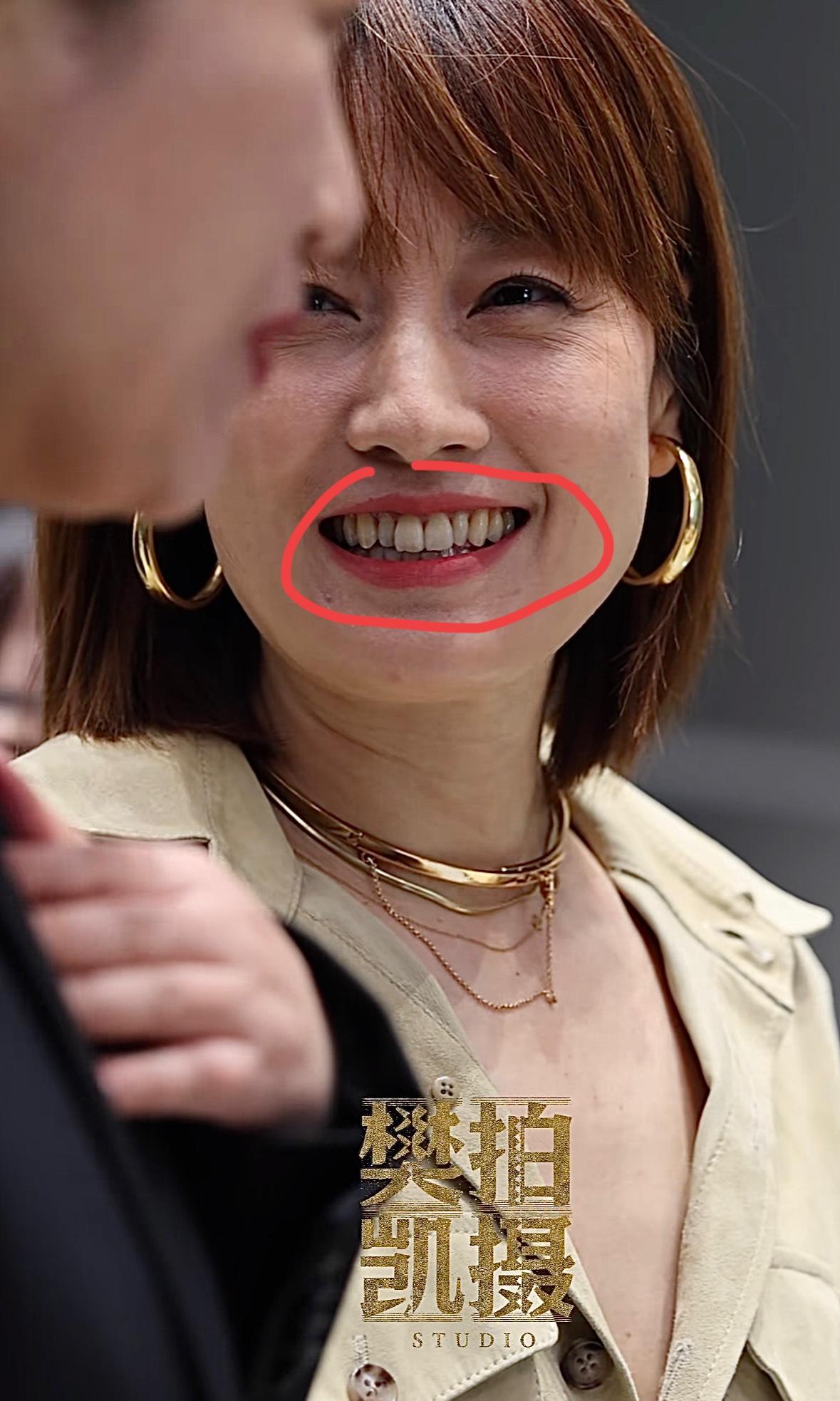 多久没见过女明星有
这么黄的牙齿了
马伊琍一个快50岁的女艺人
竟然活的如此松弛