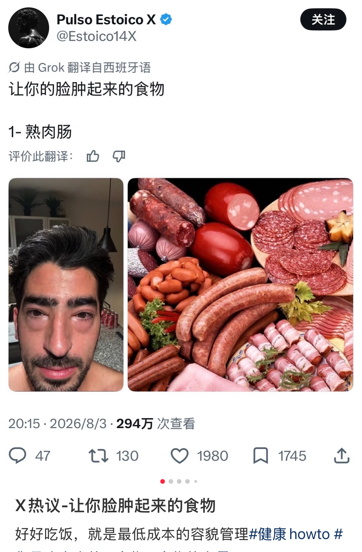 X热议-让你脸肿起来的食物 ​​​