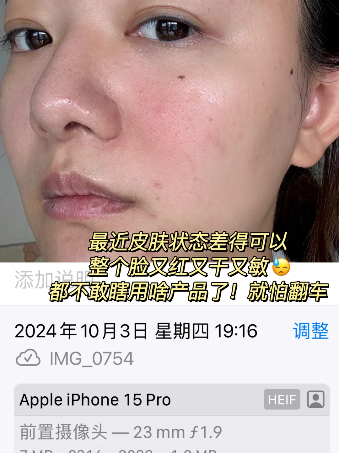 居然是它🙏🏻换季烂脸都给拉回正轨