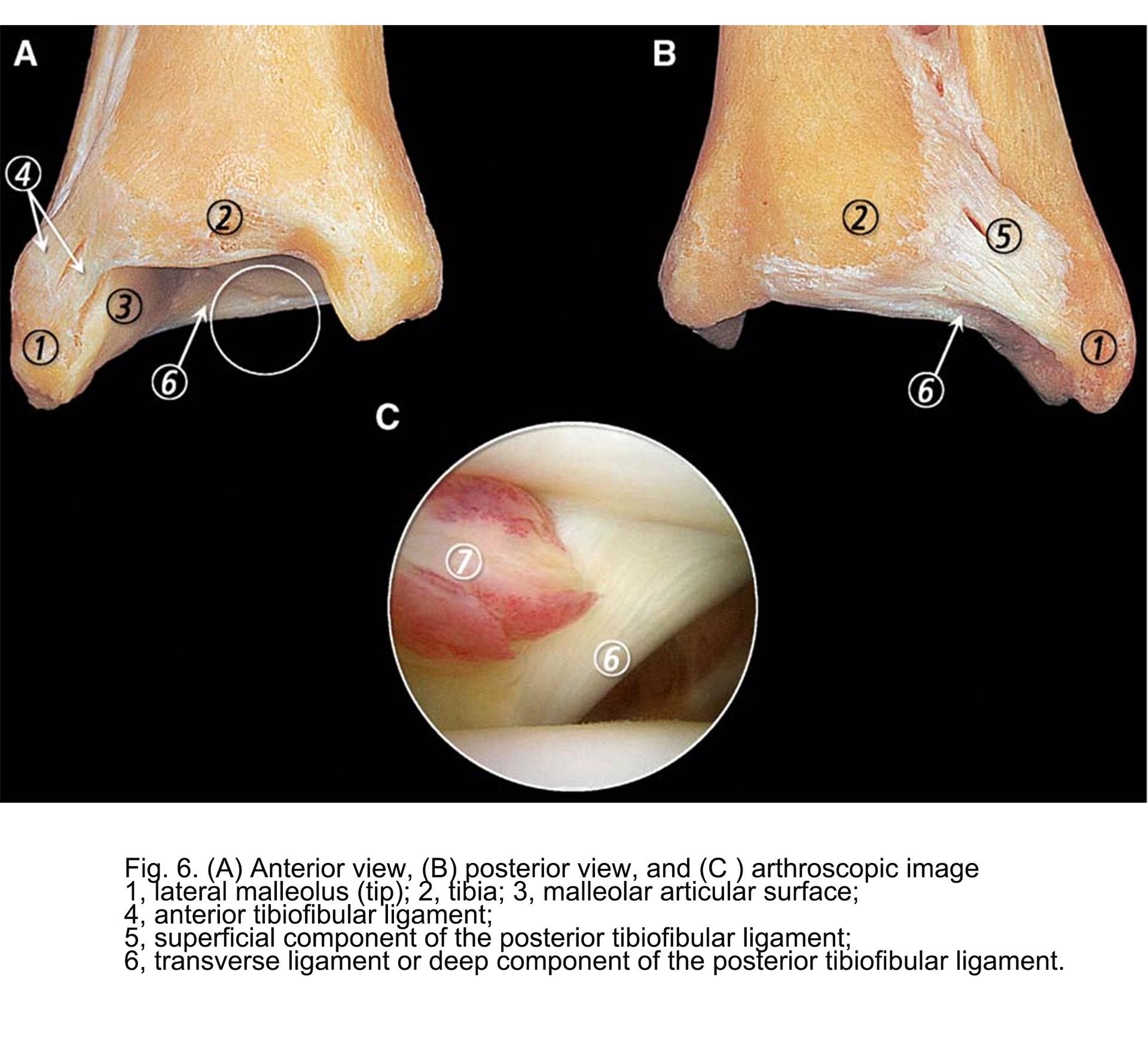 踝关节镜与大体解剖对照。