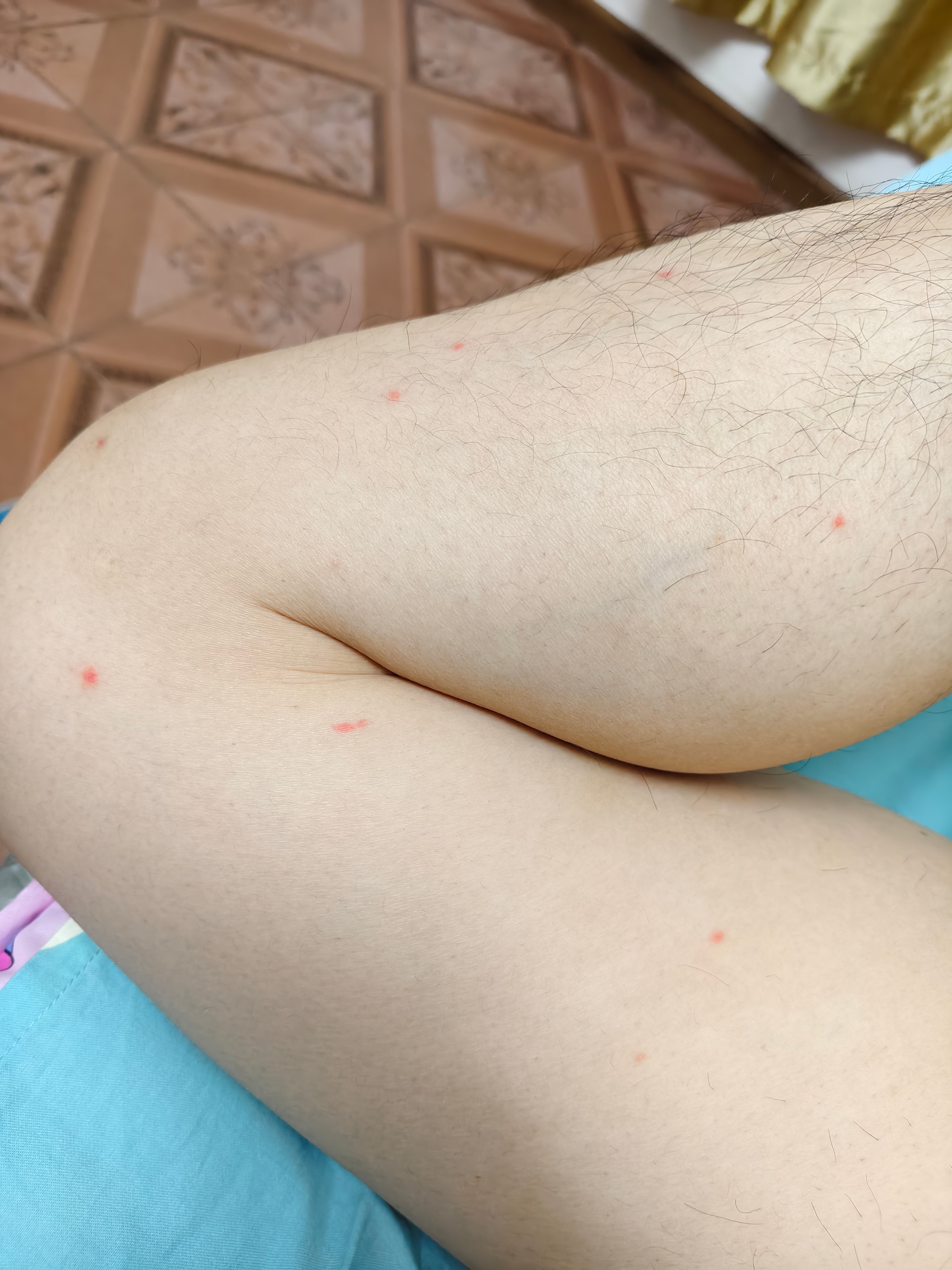 1000元以下的捕蚊灯，有推荐的吗，大腿被蚊子叮的都是红点