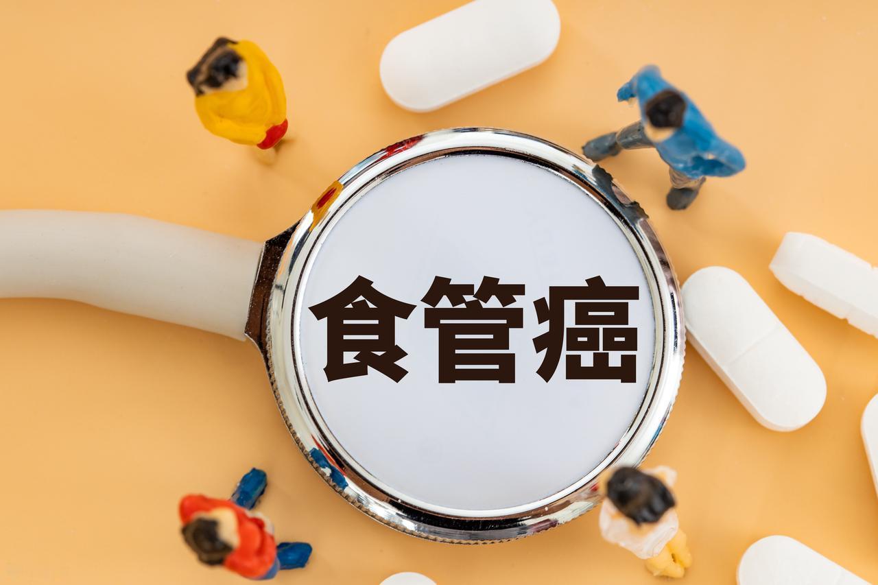 食管鳞癌，说白了就是食管癌里最常见的一种类型，尤其在咱们中国和东亚地区特别高发。