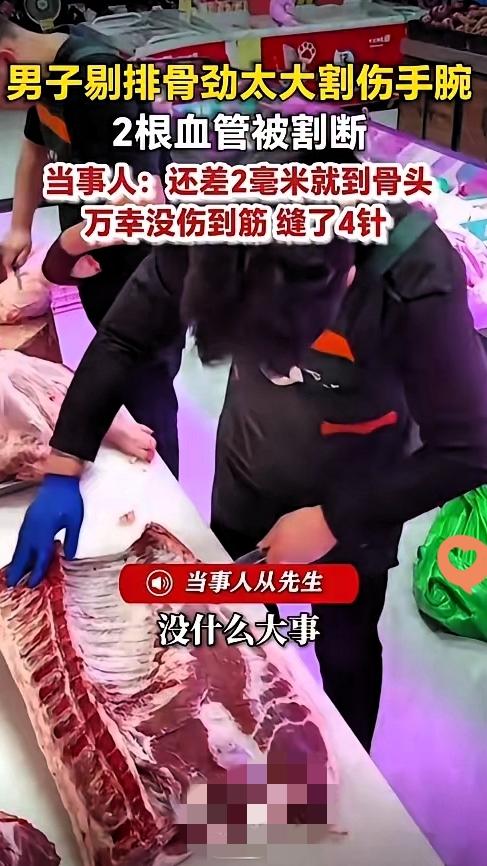 5月6日报道，浙江宁波一肉摊男子如常出摊卖肉，手持剔骨刀处理排骨时，因手上发力过